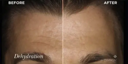 Environ Ionzyme DF Before and After
