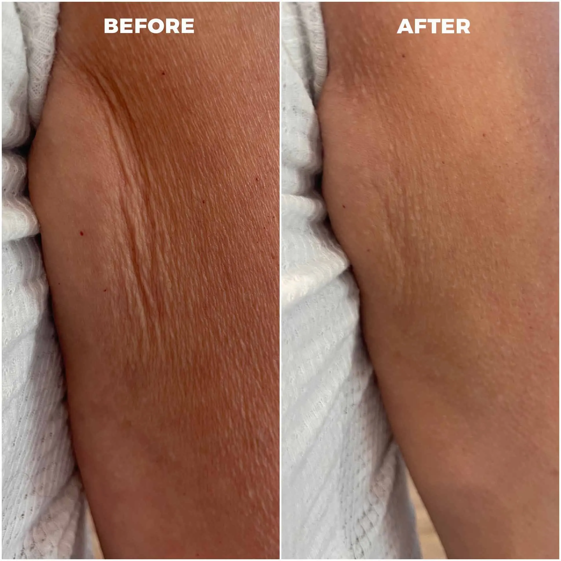 Environ Ionzyme DF Before and After